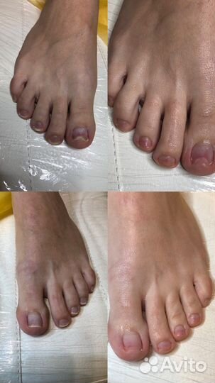 Аппаратный педикюр, подолог, покрытие