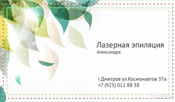Лазерная эпиляция