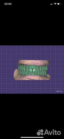 Exocad программа 3.1 Оригинал