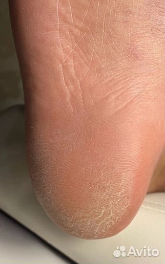 Маникюр и педикюр