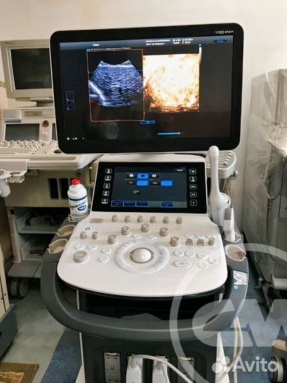 Узи аппарат для гинекологии Samsung WS80A