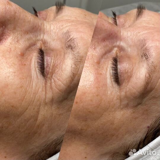 Косметолог / Массаж лица