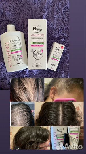 Шампунь чесночный