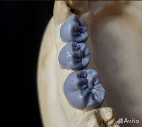 Зубной техник керамист