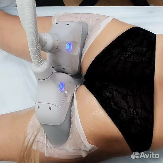Криолиполиз