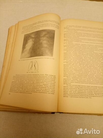 Частная патология и терапия внутренних болезней