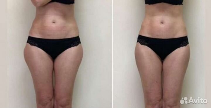 Массаж для женщин