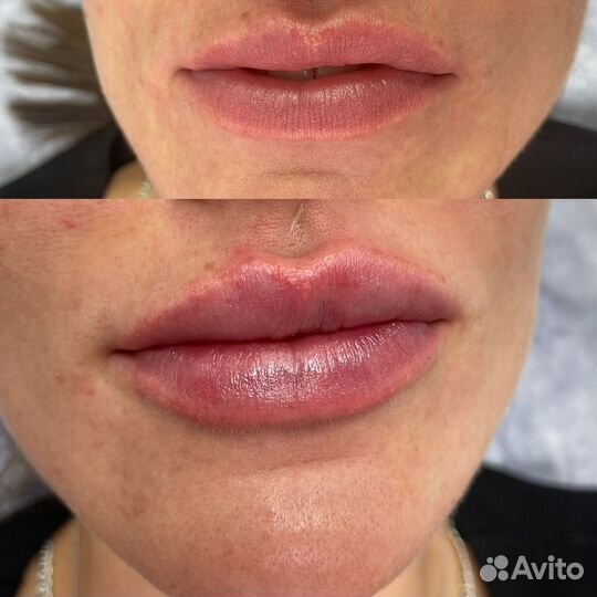 Косметология модели