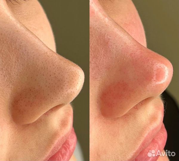 Врач косметолог