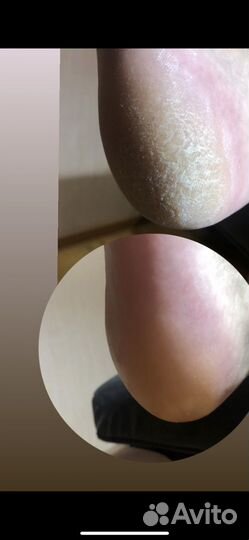 Смарт педикюр