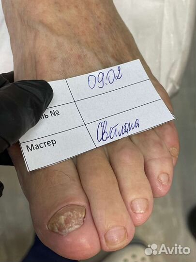 Педикюр, подологический педикюр