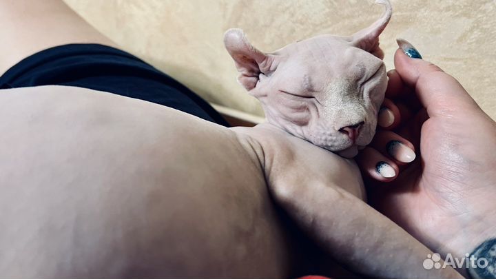 Девочка носитель гетерохромии