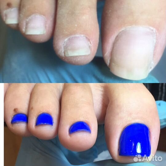 Педикюр аппаратный, основы подологии