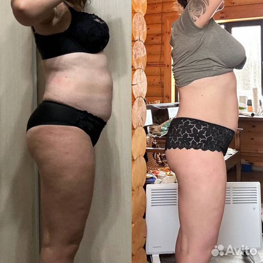 Аппаратная Коррекция фигуры