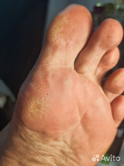 Педикюр. Здоровая эстетика и подология