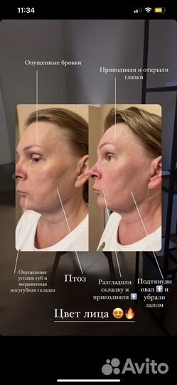 Телесная терапия/массаж