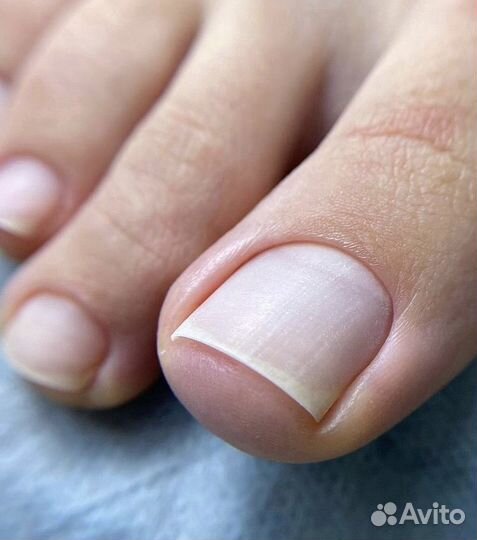 Гигиенический педикюр