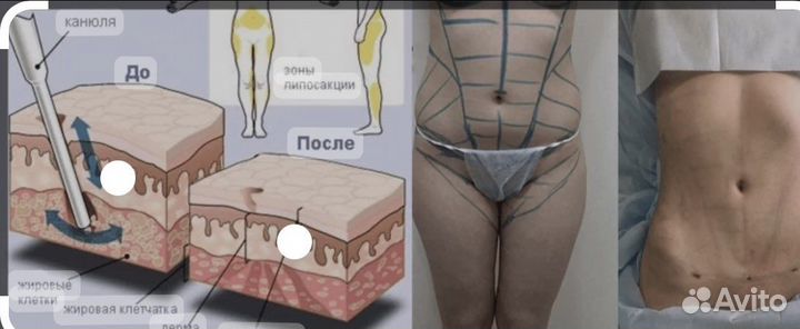 Пластическая хирургия