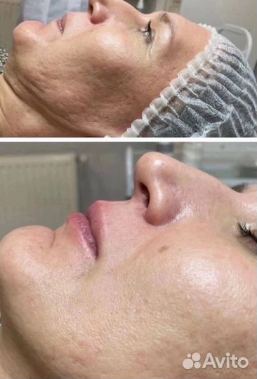 Обучение косметологии без медицинского обр-Ия