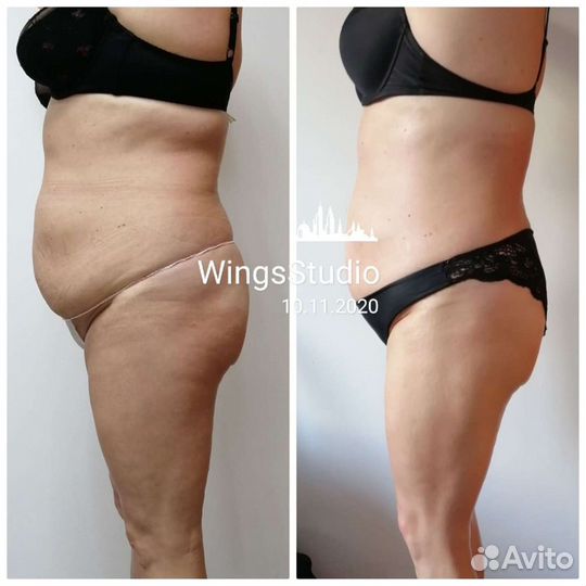 Массаж Ленинский