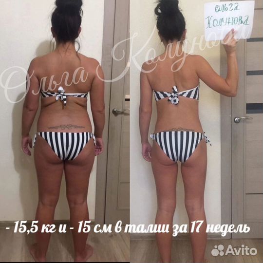 Похудеть на 5кг-7кг-15 кг, Диетолог, Целлюлит