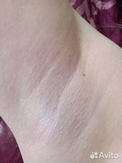 Депиляция шугаринг/воск