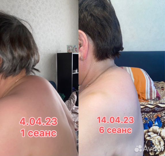 Массаж реабилитация восстановление беременность