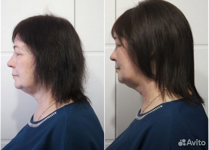 Бустап, кератин, ботокс, эковолюм