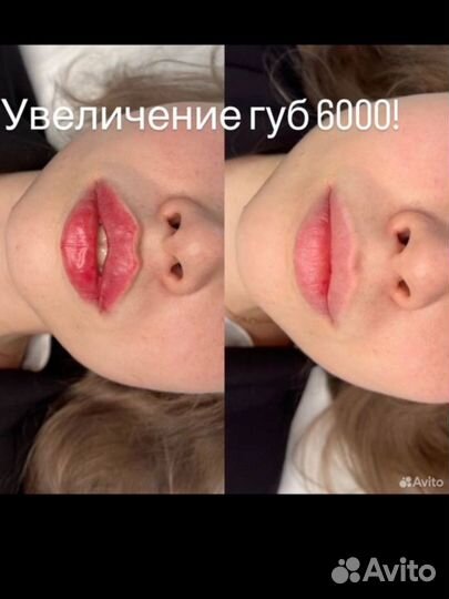 Услуги косметолога