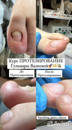 Подолог, изготовление стелек