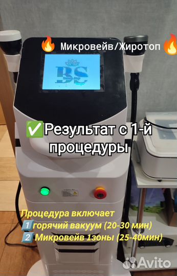 Похудение Mикровeйв жиротоп