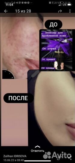 Болтушка прыщи