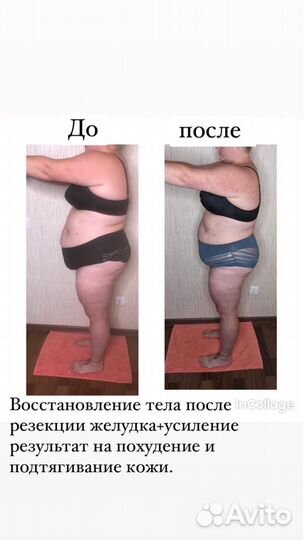 Антицеллюлитный массаж ручной