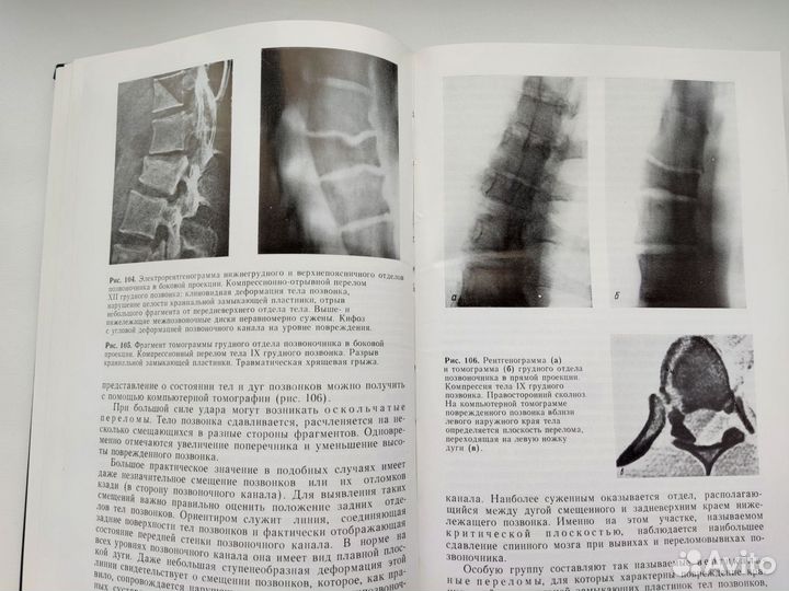 Книга Неотложная рентгенодиагностика Кишковский