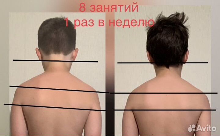 Инструктор по ЛФК