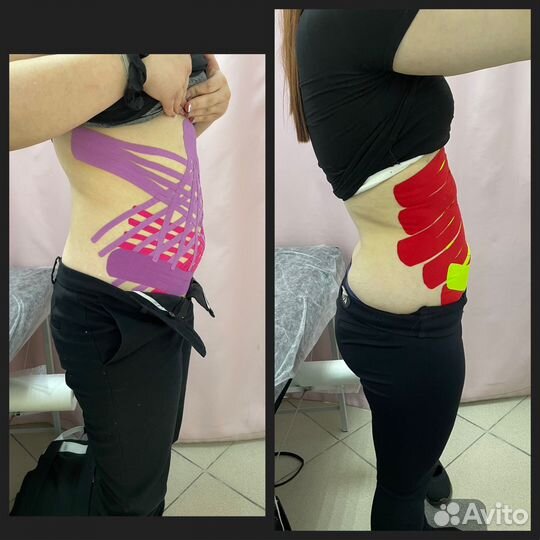 Тейпирование тела и лица