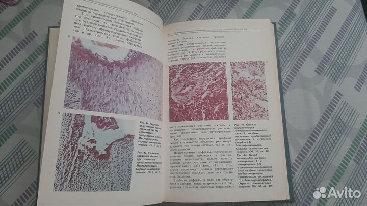 Атлас заболеваний слизистой оболочки рта