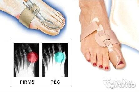 Бандаж-фиксатор для коррекции большого пальца