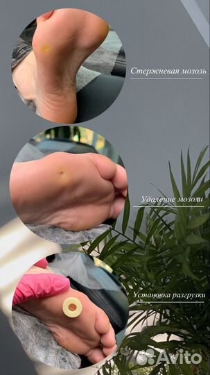 Подология/педикюр