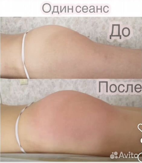 Массаж на результат, не поглаживаю. Депиляция