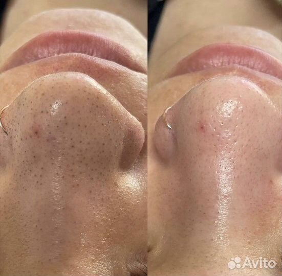 Услуги косметолога