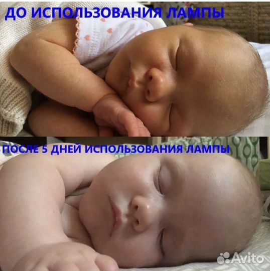 Лампа от желтухи