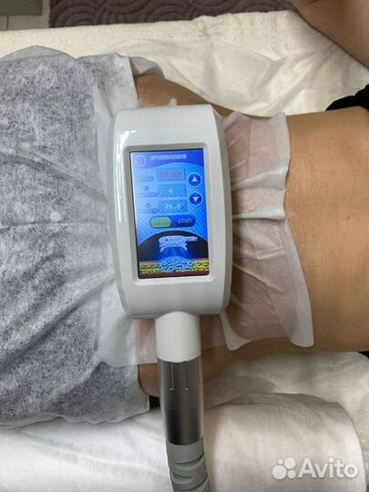 Криолиполиз