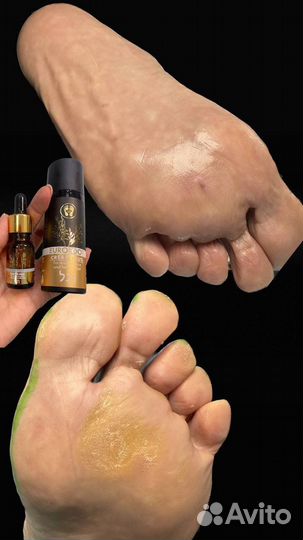 Крем от трещин eurofoot Cream Plus