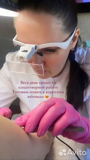 Электроэпиляция