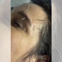 Массаж лица