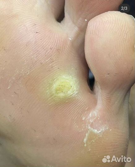 Услуги подолога