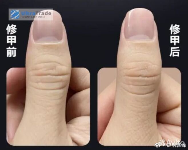 Маникюрный набор Xiaomi Huanxing Nail Clippers