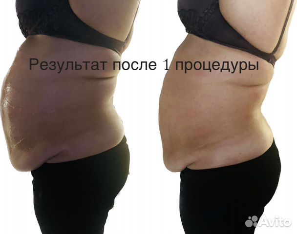 Ларгус косметология брянск