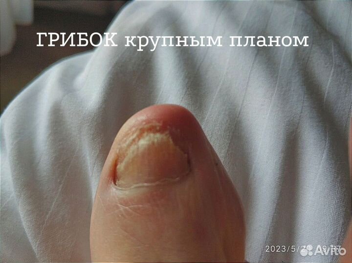 Желудочный сок гюрзы 10%